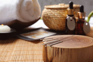 Acupuncture treatment with thin needles during a wellness session in Franklin, Tennessee
