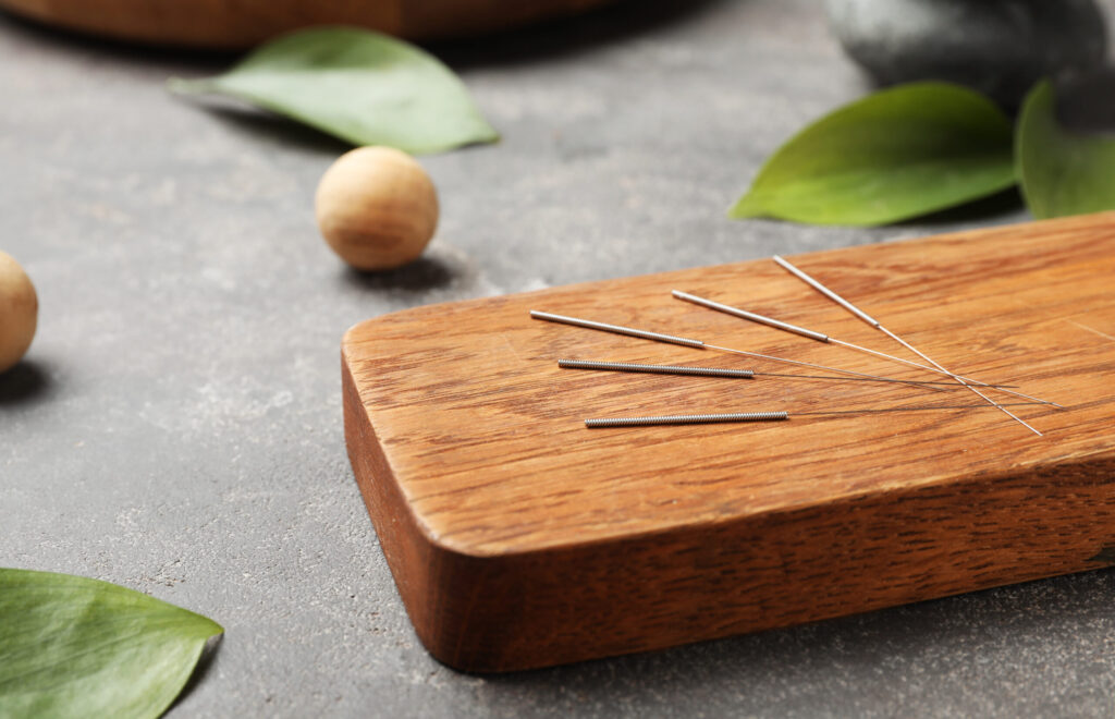Acupuncture treatment with thin needles during a wellness session in Franklin, Tennessee