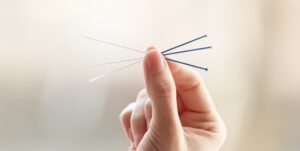 Franklin Acupuncture and Herbal Medicine clinic offering acupuncture and holistic treatments in Franklin, Tennessee