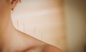 Acupressure and holistic wellness services at Tennessee Alternative Medicine in Franklin, Tennessee