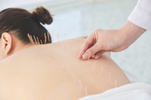 WY Acupuncture Clinic offering Traditional Chinese Medicine and acupuncture services in Franklin, Tennessee